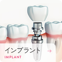 インプラント