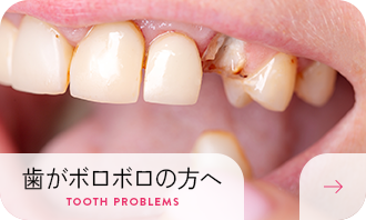 歯がボロボロの方へ