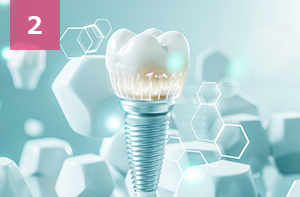 インプラント経験25年以上　累計症例数30,000人以上の実績