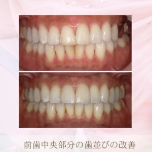 審美歯科とは？