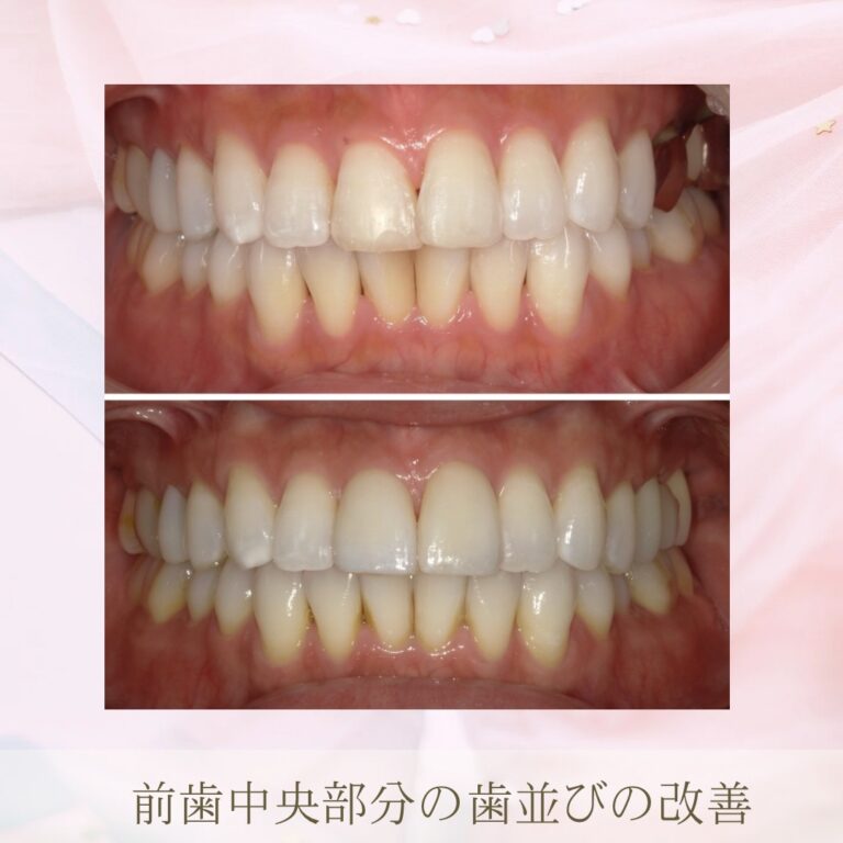 審美歯科とは？