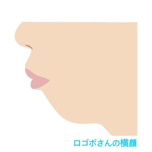 口ゴボさんは歯列矯正でスッキリ！