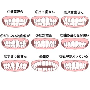 当院で取り扱いのあるインビザラインの種類について ✨