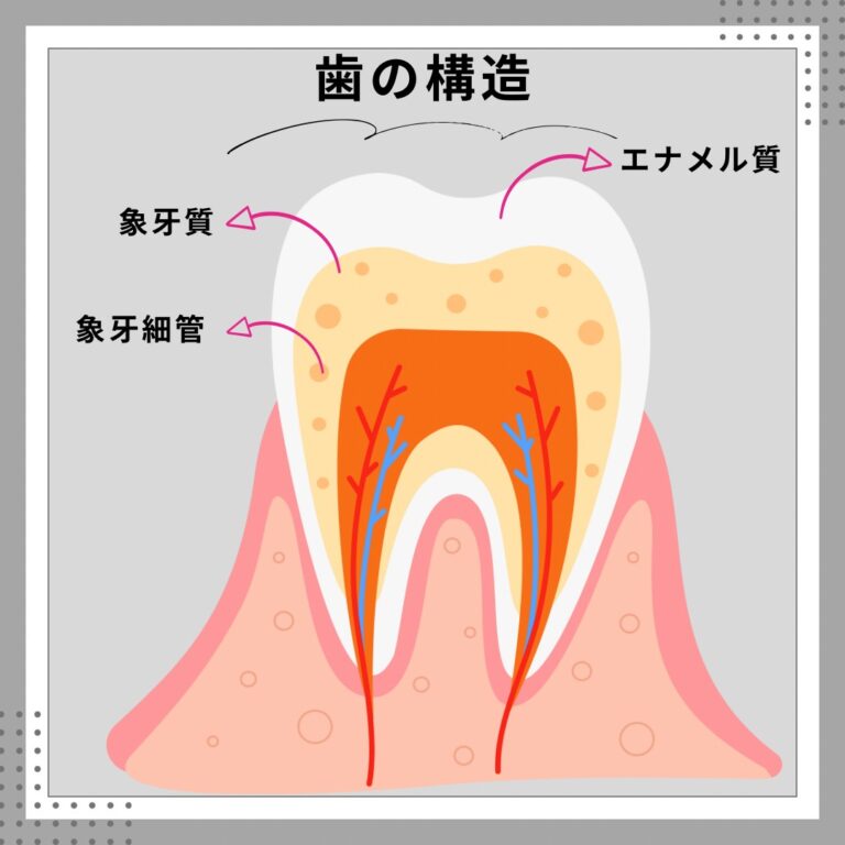 治療後に歯がしみる！なぜ？