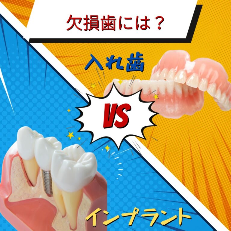 インプラント vs 入れ歯