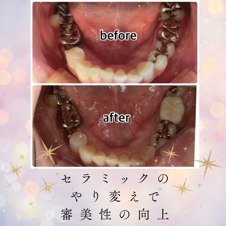 テスト症例
